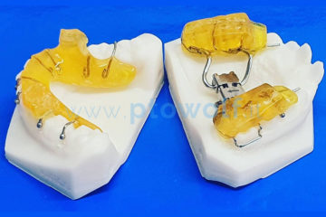 dispositivo-twin-block-su-modelli-3D-con-espansore-rapido